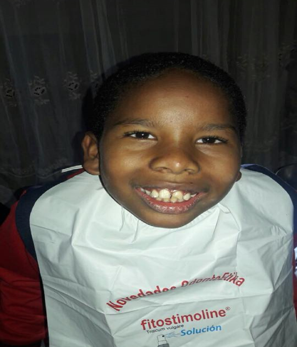 mini diseño de sonrisa en cali